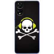 Чохол BoxFace TCL 505 