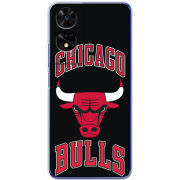 Чохол BoxFace TCL 505 