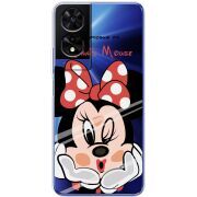 Прозорий чохол BoxFace TCL 505 Lady M