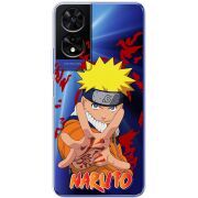 Прозорий чохол BoxFace TCL 505 Naruto