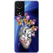 Чохол зі стразами TCL 505 Heart