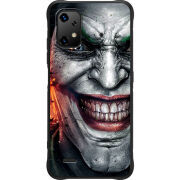 Чохол BoxFace Umidigi Bison X20 Prankster