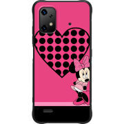 Чохол BoxFace Umidigi Bison X20 