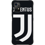 Чохол BoxFace Umidigi Bison X20 FC J