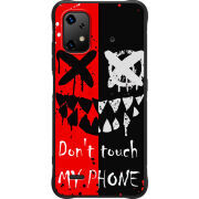 Чохол BoxFace Umidigi Bison X20 Bad Smile