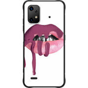 Чохол BoxFace Umidigi Bison X20 