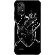 Чохол BoxFace Umidigi Bison X20 