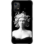 Чохол BoxFace Umidigi Bison X20 