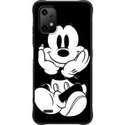 Чохол BoxFace Umidigi Bison X20 