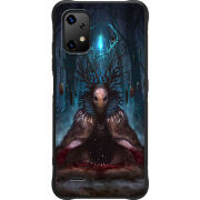 Чохол BoxFace Umidigi Bison X20 