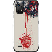 Чохол BoxFace Umidigi Bison X20 