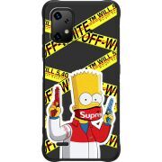 Чорний чохол BoxFace Umidigi Bison X20 White Bart