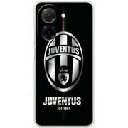 Чохол BoxFace Poco C71 