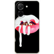 Чохол BoxFace Poco C71 