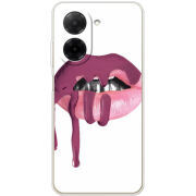 Чохол BoxFace Poco C71 