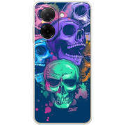 Чохол BoxFace Poco C71 