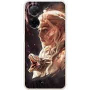 Чохол BoxFace Poco C71 