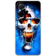 Чохол BoxFace Poco C71 