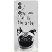 Чохол BoxFace Honor 70 