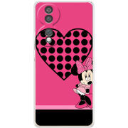 Чохол BoxFace Honor 70 