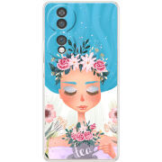 Чохол BoxFace Honor 70 