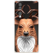 Чохол BoxFace Honor 70 