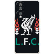 Чохол BoxFace Honor 70 L. F. C.