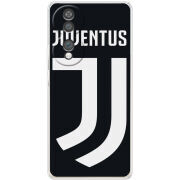 Чохол BoxFace Honor 70 FC J