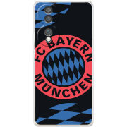 Чохол BoxFace Honor 70 FC Bayern