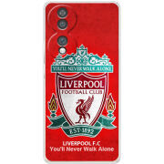 Чохол BoxFace Honor 70 