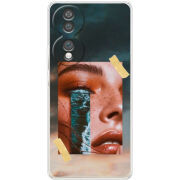 Чохол BoxFace Honor 70 