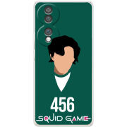 Чохол BoxFace Honor 70 siquid game 456