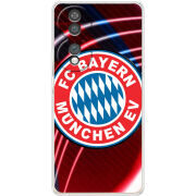 Чохол BoxFace Honor 70 