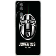 Чохол BoxFace Honor 70 