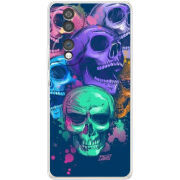 Чохол BoxFace Honor 70 