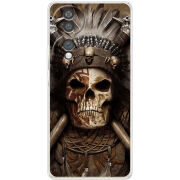 Чохол BoxFace Honor 70 