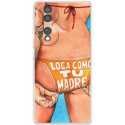 Чохол BoxFace Honor 70 