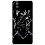 Чохол BoxFace Honor 70 