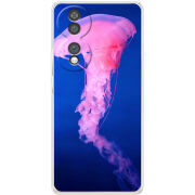 Чохол BoxFace Honor 70 