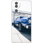 Чохол BoxFace Honor 70 