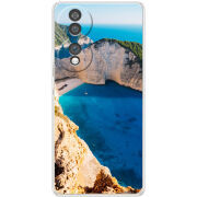 Чохол BoxFace Honor 70 