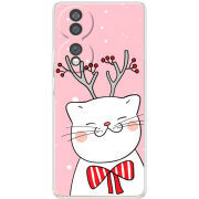 Чохол BoxFace Honor 70 