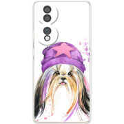 Чохол BoxFace Honor 70 