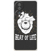 Чохол BoxFace Honor 70 