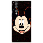 Чохол BoxFace Honor 70 