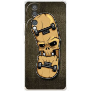 Чохол BoxFace Honor 70 