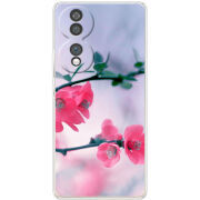 Чохол BoxFace Honor 70 