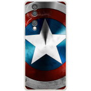 Чохол BoxFace Honor 70 