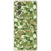 Чохол BoxFace Honor 70 