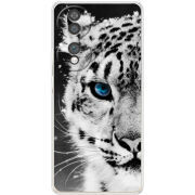 Чохол BoxFace Honor 70 